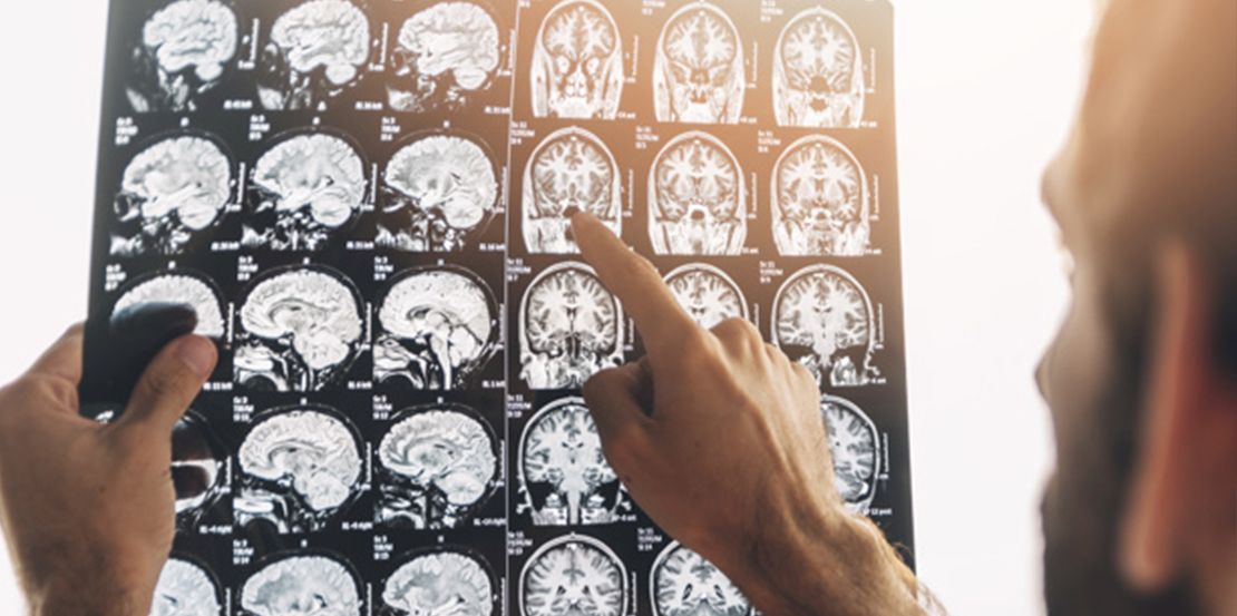 Neurocirugía