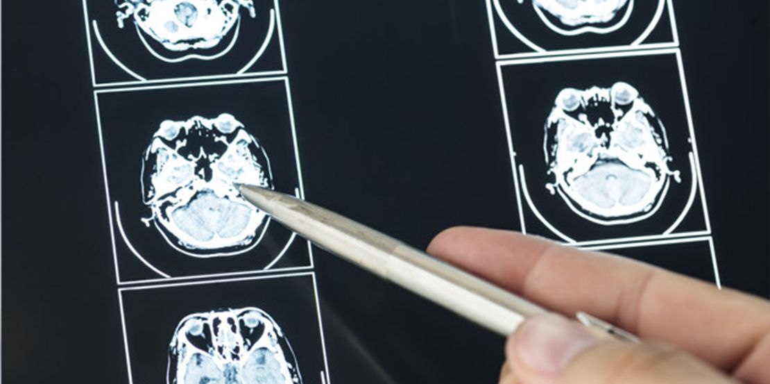 Neurología