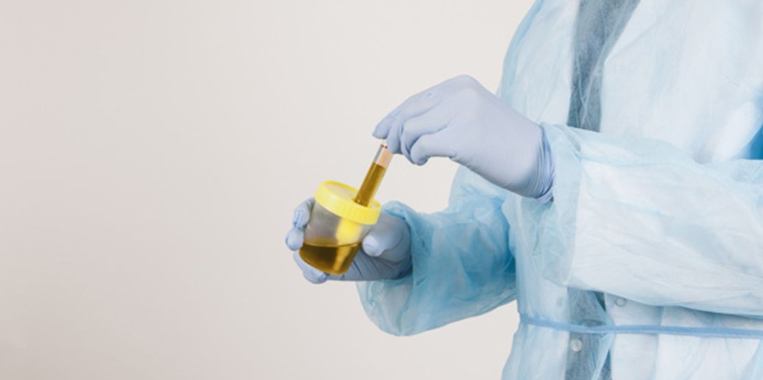 Urología